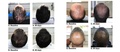 Plaukų augimą skatinanti priemonė Spectral.DNC-L